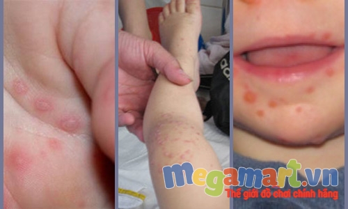 Các bệnh thường gặp khi cho bé tập bơi và cách phòng tránh 8