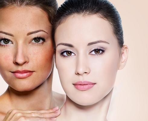 Viên uống Phytoceramides có thật sự làm đẹp da? vien-uong-dep-da-phytoceramides