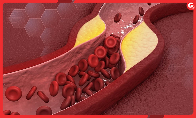 cai-thien-suc-khoe-tim-mach