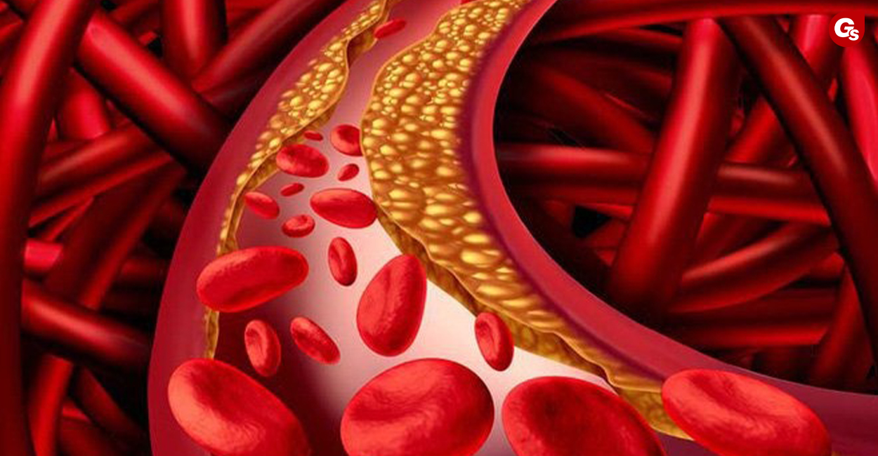 chat-beo-trung-tinh-la-gi-gymstore-1