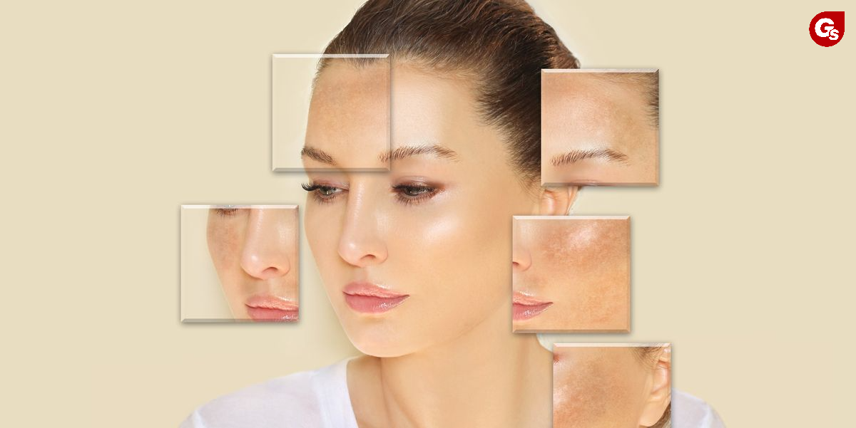 collagen-tri-nam-gymstore-2