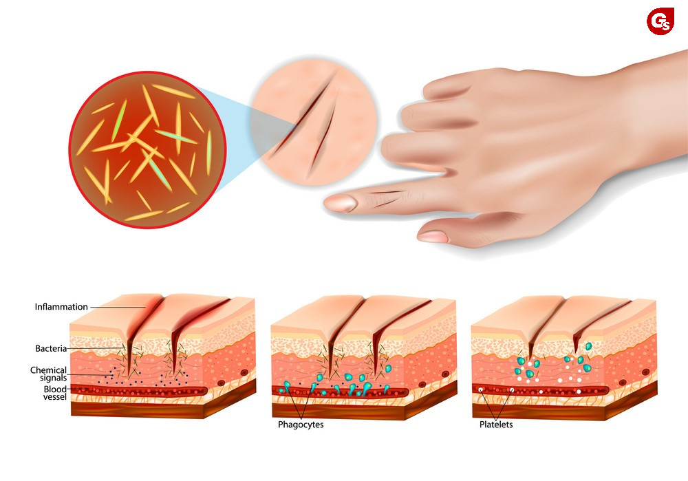 zinc-gluconate-la-gi-gymstore-2