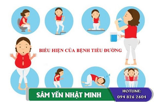 các triệu chứng bệnh tiểu đường