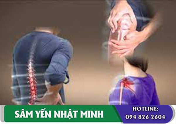 Nhung hươu giúp người già phòng chống các bệnh về xương khớp