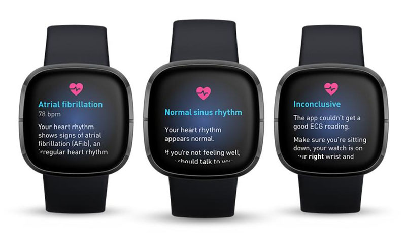 Tính năng ECG trên đồng hồ thông minh