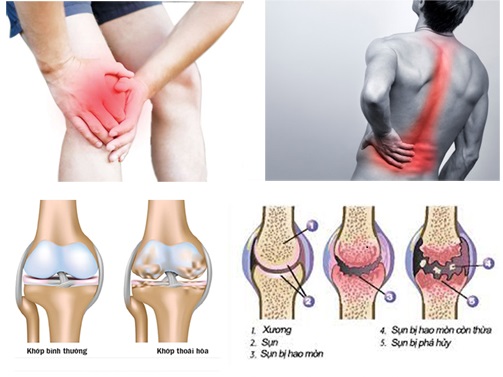 công dụng glucosamin orihiro