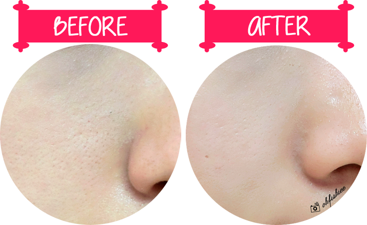 công dụng serum vitamin C melano CC rotho