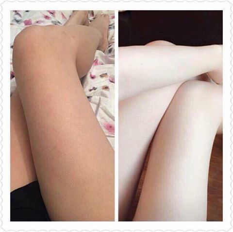 vien uong trang da relumins