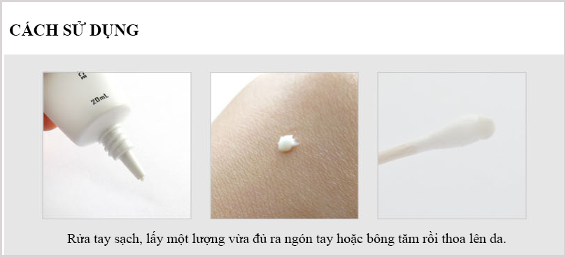 Mỹ phẩm queenie Kem đặc trị mụn trứng cá, mụn bọc, mụn mủ Queenie