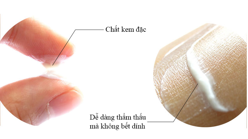 Mỹ phẩm queenie Kem đặc trị mụn trứng cá, mụn bọc, mụn mủ Queenie
