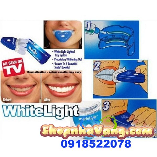 Dụng Cụ Làm Trắng Răng Tiện Lợi White Light NV166