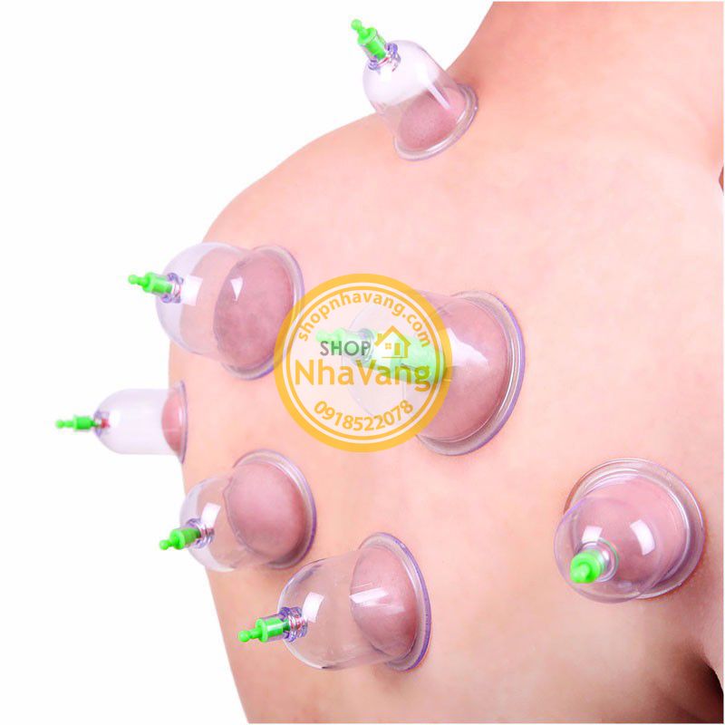 Bộ Giác Hơi Không Sử Dụng Lửa 12 Ly NV343