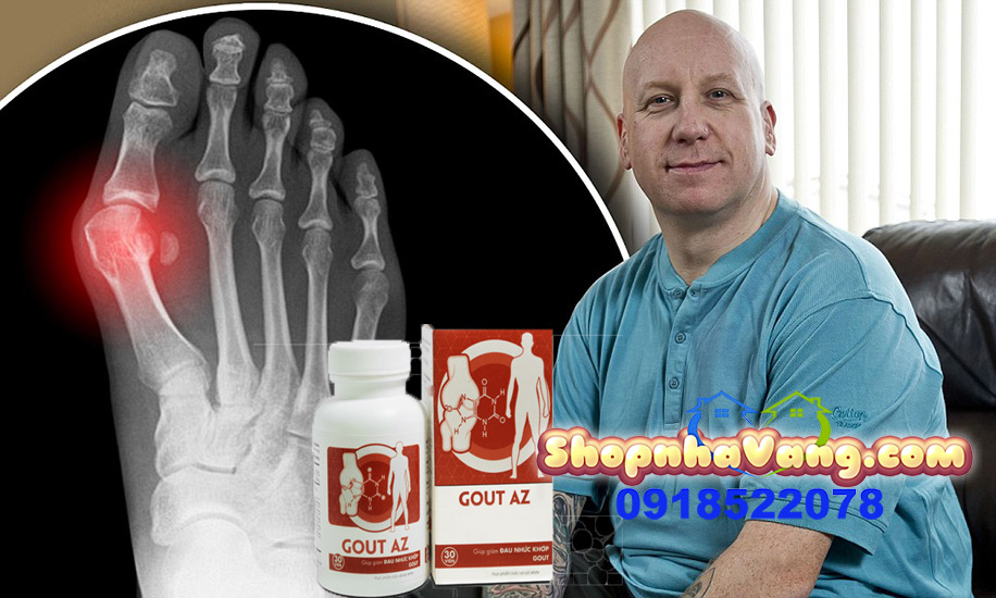 Thực Phẩm Chức Năng Gout AZ Giúp Giảm Đau Nhức Khớp Gout NV481
