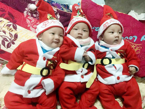 3 ca sinh con nằm trong bọc ối hy hữu tại Việt Nam khiến bác sĩ ngỡ ngàng