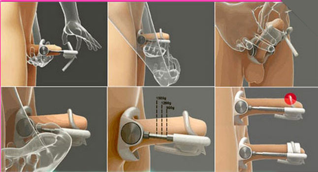 sử dụng máy tập dương vật proextender
