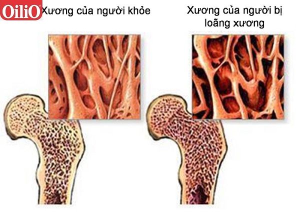Đậu nành tốt cho phụ nữ tuổi mãn kinh
