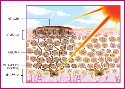 Nano curcumin trong tinh chất nghệ trị nám da