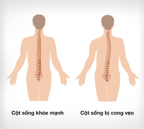 Nếu người điều khiển ngồi sai cách, cột sống sẽ bị ảnh hưởng