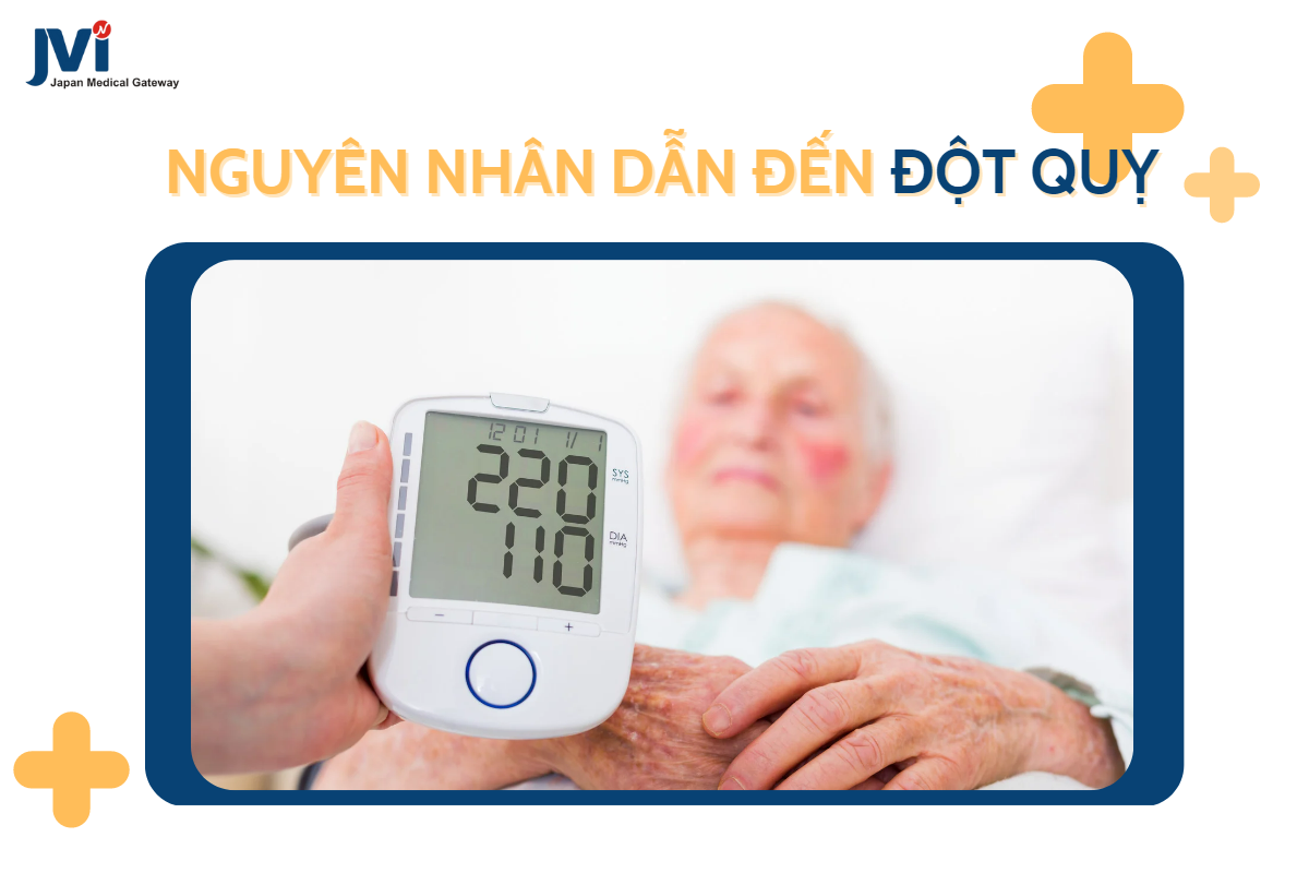 Nguyên nhân dẫn đến đột quỵ