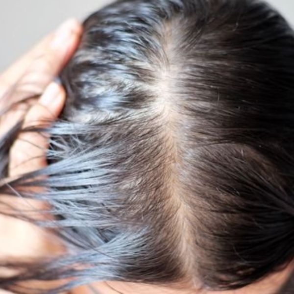 Khi bước sang tuổi trung niên, mái tóc của bạn có thể thay đổi rõ rệt: tóc mỏng đi, dễ gãy rụng, bạc màu nhanh chóng hoặc mất đi độ bóng mượt ngày nào