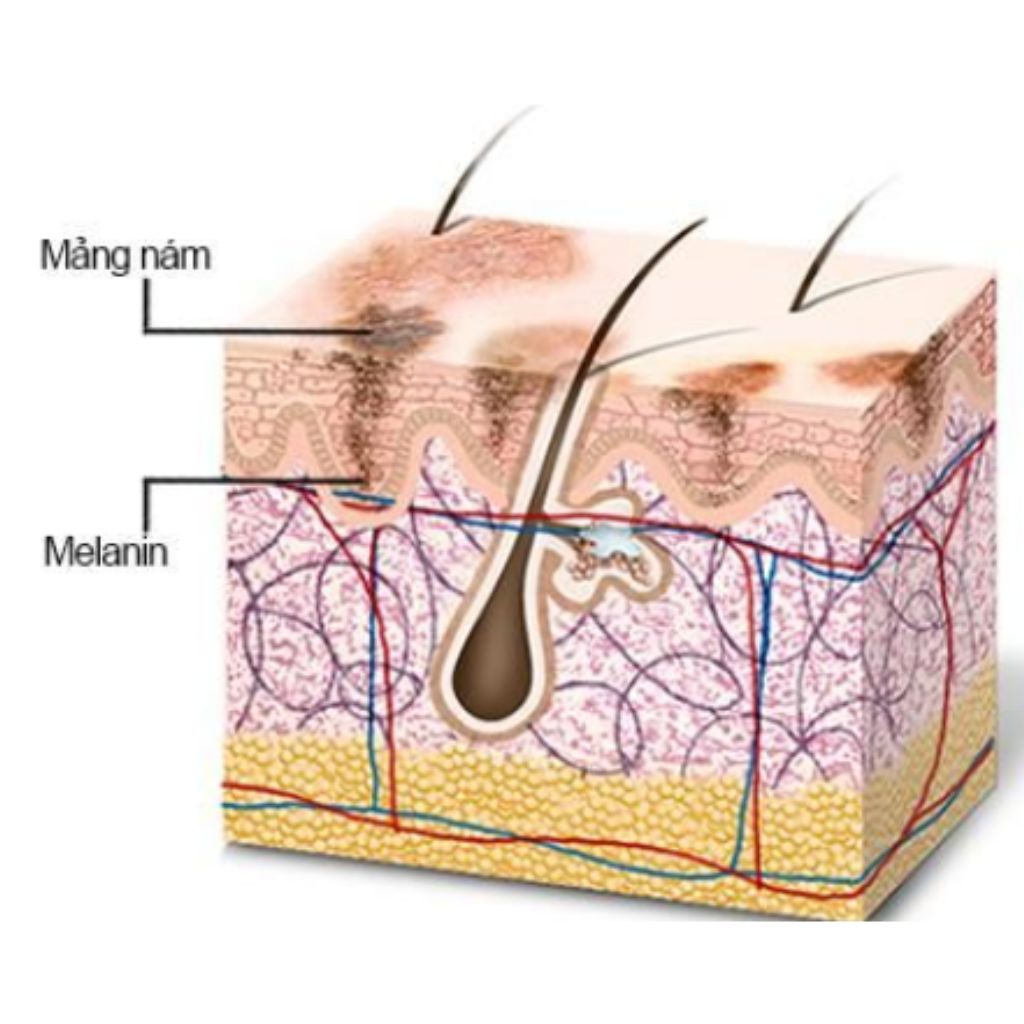 Cơ chế gây bạc tóc