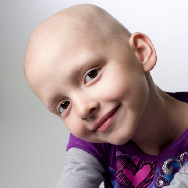 Bệnh nhân bị mất tóc do hóa trị