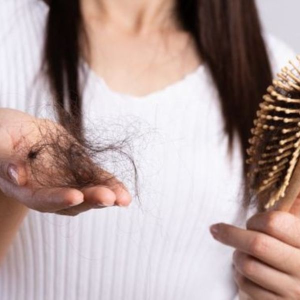 Rụng tóc nhiều tác động đến đời sống xã hội và quan hệ cá nhân