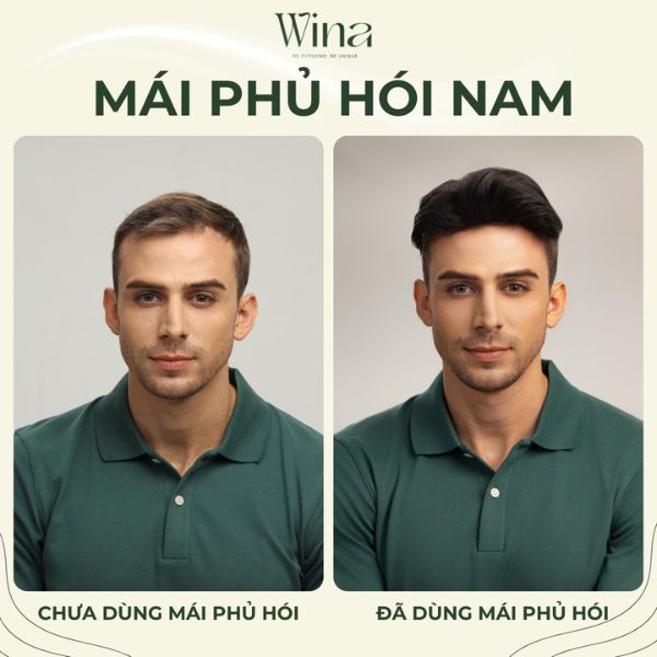 Tóc giả không chỉ giúp che đi những khuyết điểm mà còn mang lại vẻ ngoài tự tin và lịch lãm