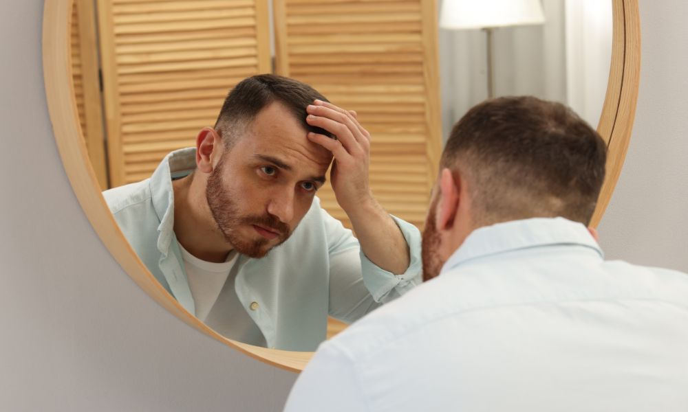 Bước vào tuổi trung niên, nhiều quý ông bắt đầu đối mặt với "nỗi lo thầm kín": tóc thưa dần, đường chân tóc bắt đầu lùi lại