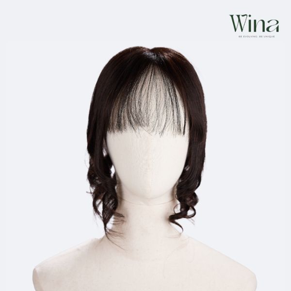 Rụng tóc không chỉ ảnh hưởng đến vẻ ngoài mà còn khiến nhiều người mất đi sự tự tin vốn có