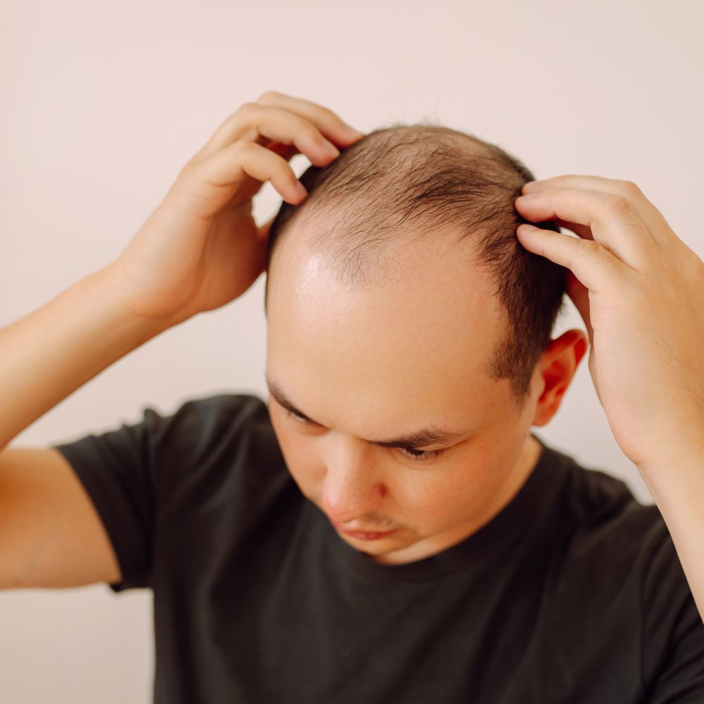 Khi mất ngủ, quá trình lưu thông máu đến da đầu bị trì trệ, khiến nang tóc bị "bỏ đói"