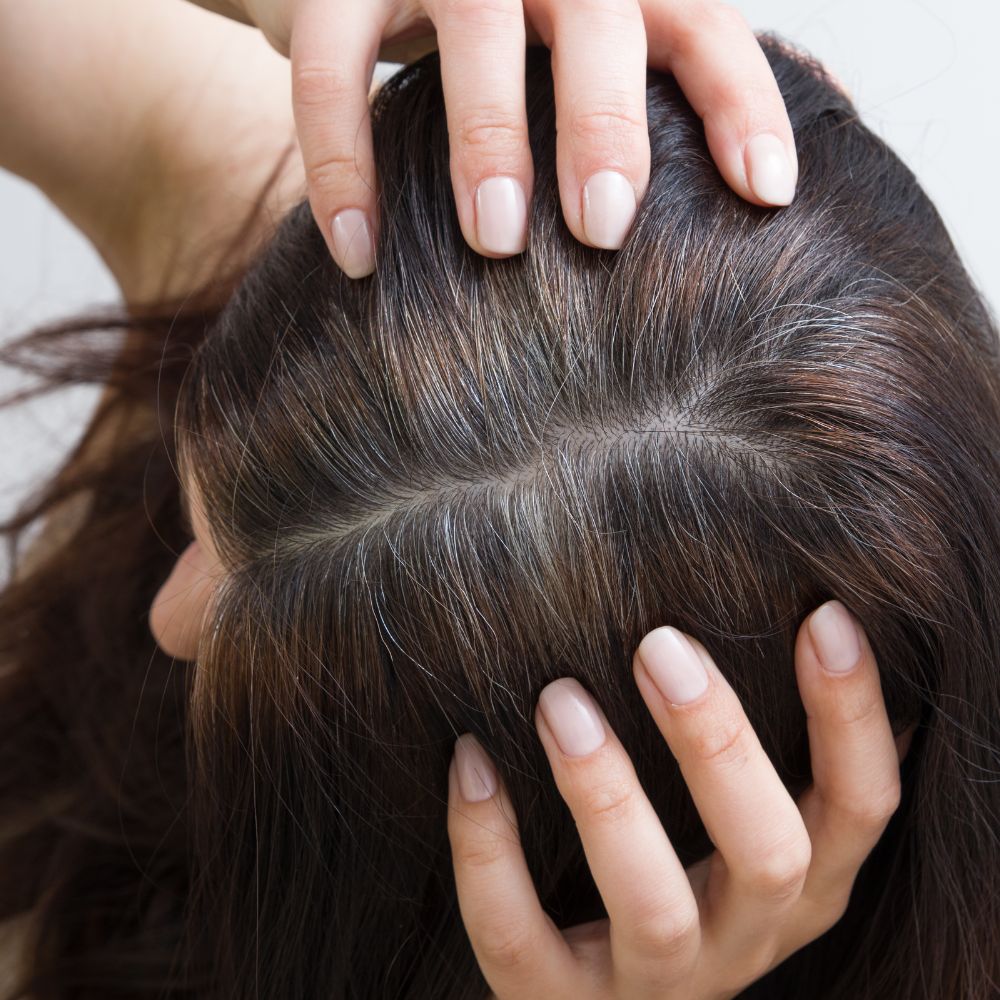 Các tổn thương do hóa chất tích tụ sẽ gây ra tình trạng viêm chân tóc mãn tính