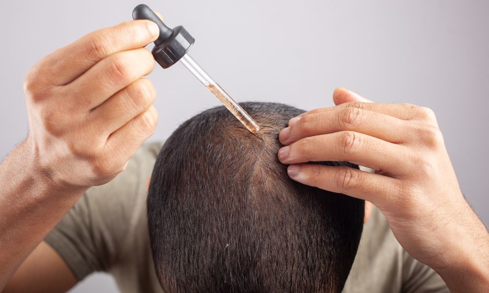 Các loại thuốc như Minoxidil và Finasteride (dạng uống) có thể giúp làm chậm quá trình rụng và kích thích tóc mọc lại