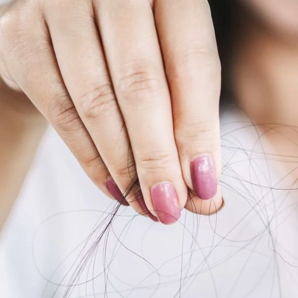 Rụng tóc nhiều ở nữ khiến tâm lý suy sụp