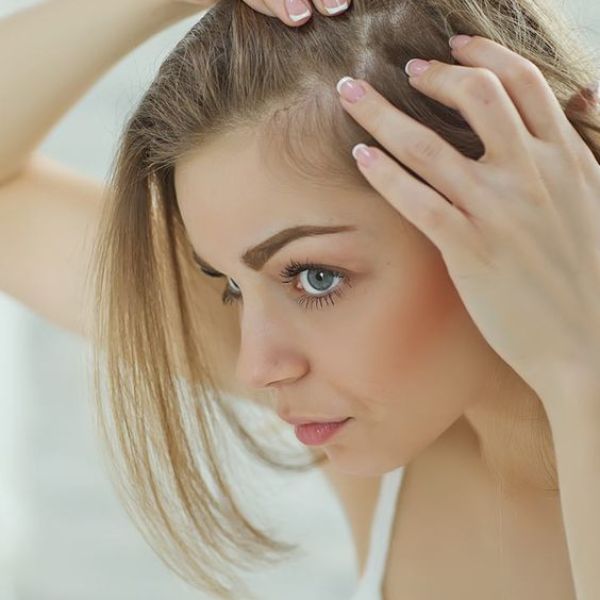 Việc rụng tóc nhiều khiến trở nên hói và tự ti với các mối quan hệ