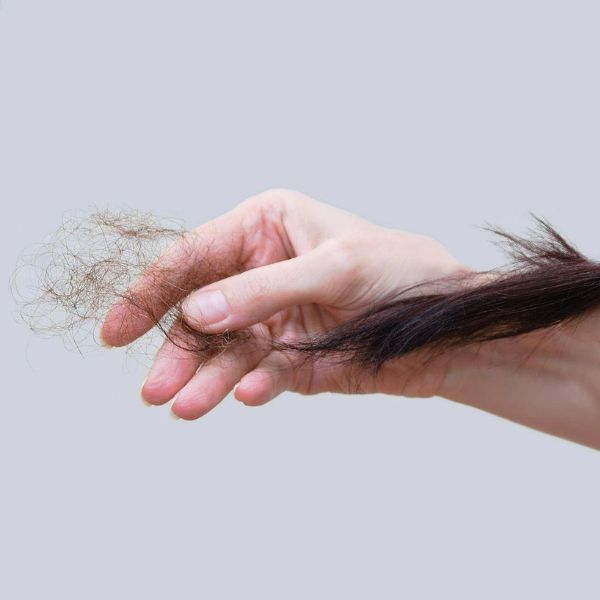 Tóc giả cho người rụng tóc nhiều