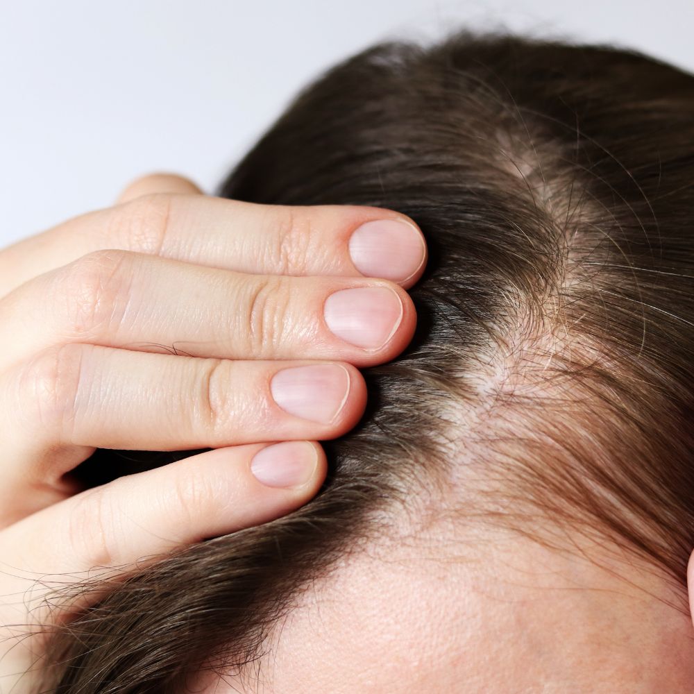 Theo các nghiên cứu da liễu, vào cuối thu và mùa đông, tóc có xu hướng rụng nhiều hơn so với mùa hè