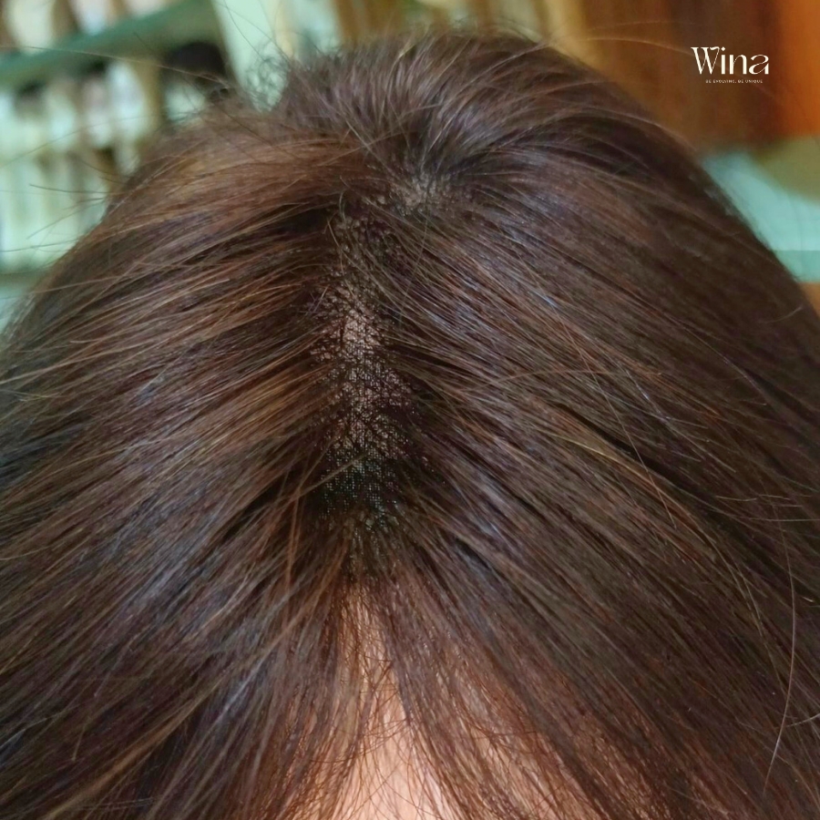 Thị trường tóc giả ngày càng phát triển và đa dạng