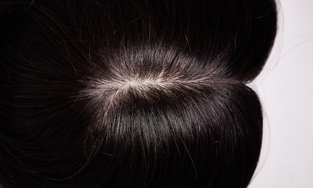 Đối với tóc giả cao cấp, phần đỉnh đầu (đường ngôi) được làm bằng công nghệ siêu da đầu (Lace Front hoặc Silk Top)