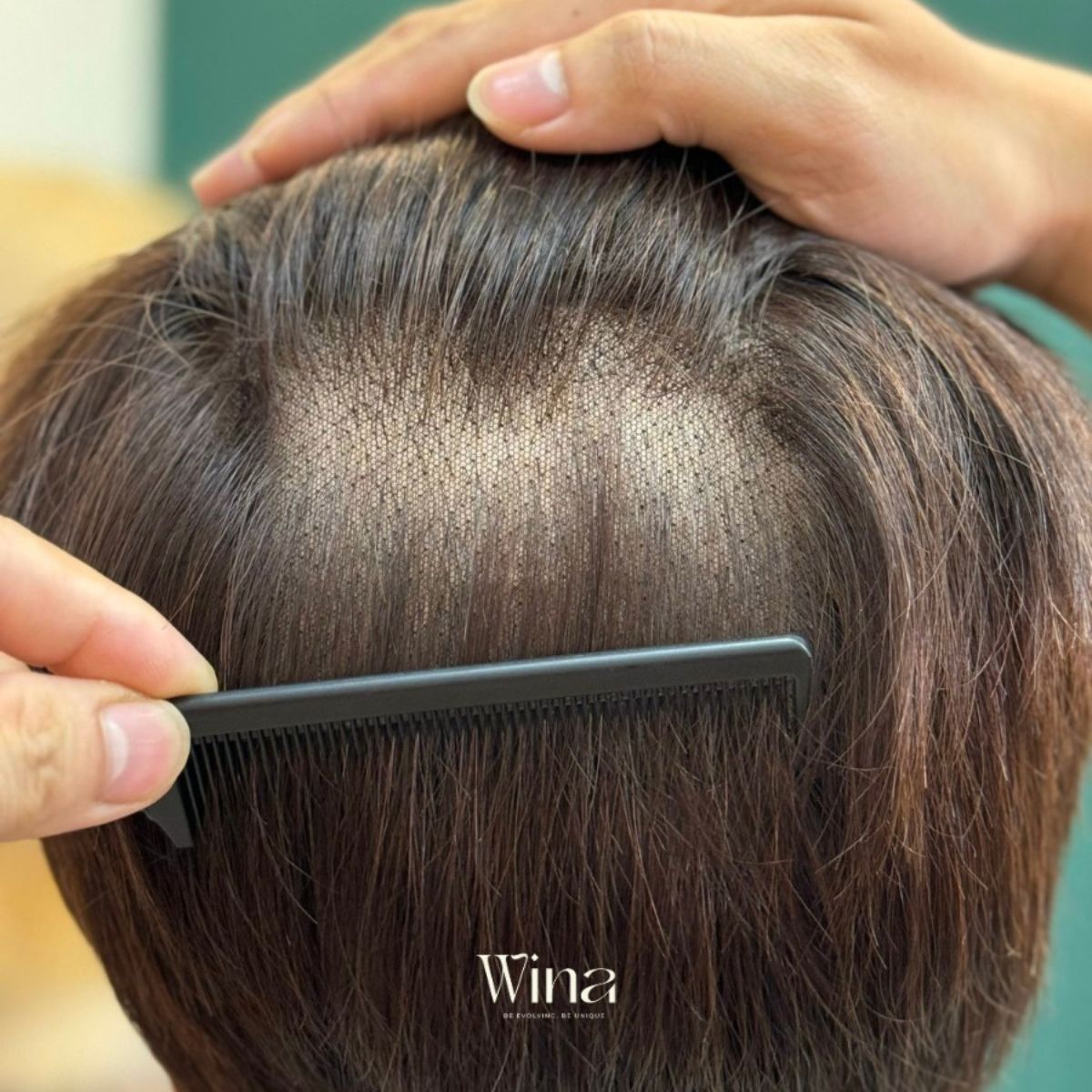 Tóc giả che hói nữ chất lượng ngày càng tốt