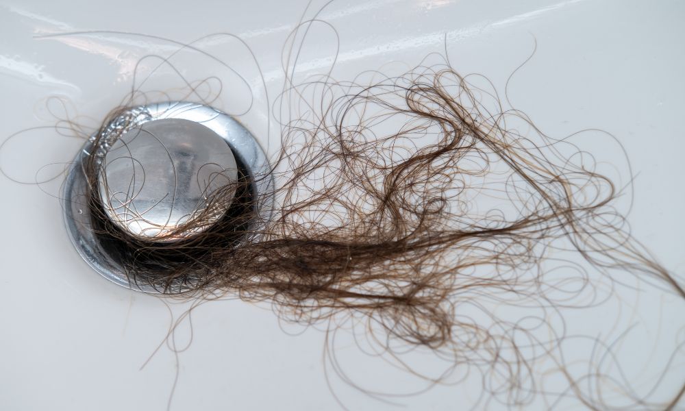 Tóc rụng sau sinh là vấn đề hầu hết các mẹ bỉm sữa đều gặp phải