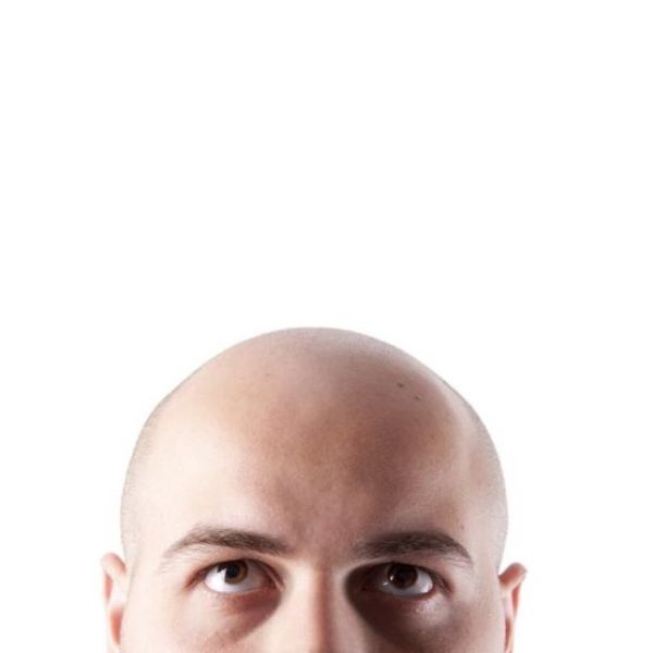 Tóc giả hỗ trợ quá trình hồi phục tinh thần