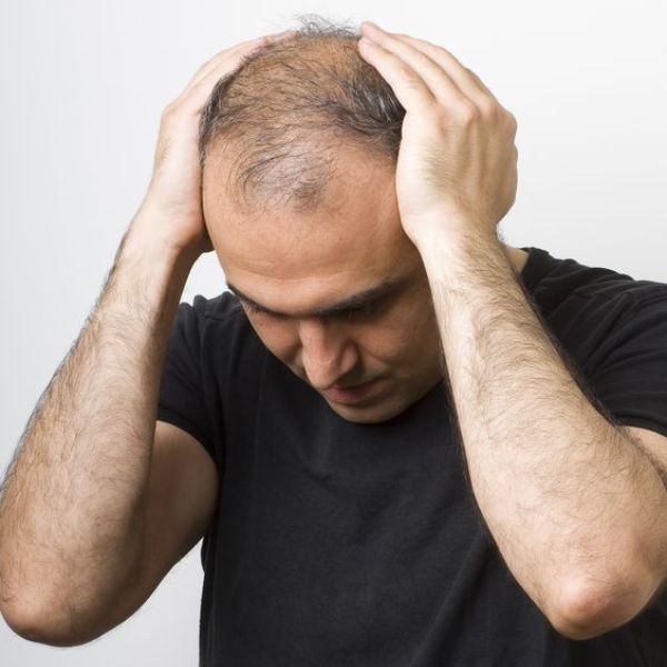 Giải pháp cho tình trạng khuyết điểm về tóc với tóc giả nam