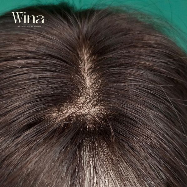 Tóc giả tại Wina Wigs được làm từ tóc thật 100%, đảm bảo độ mềm mượt, tự nhiên và bền đẹp