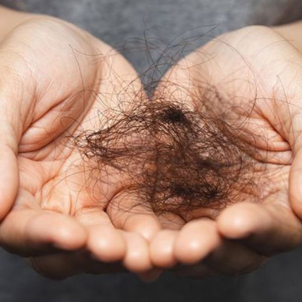 Tóc giả giúp người bệnh tự tin hơn