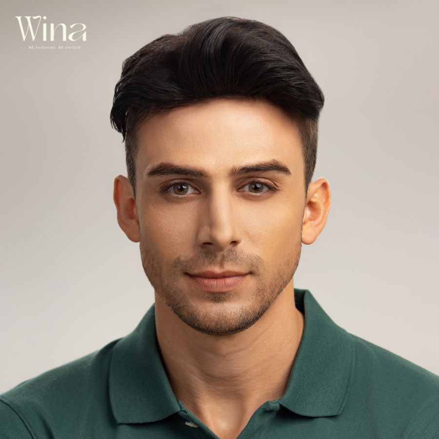 Tóc mái hói nam phổ biến