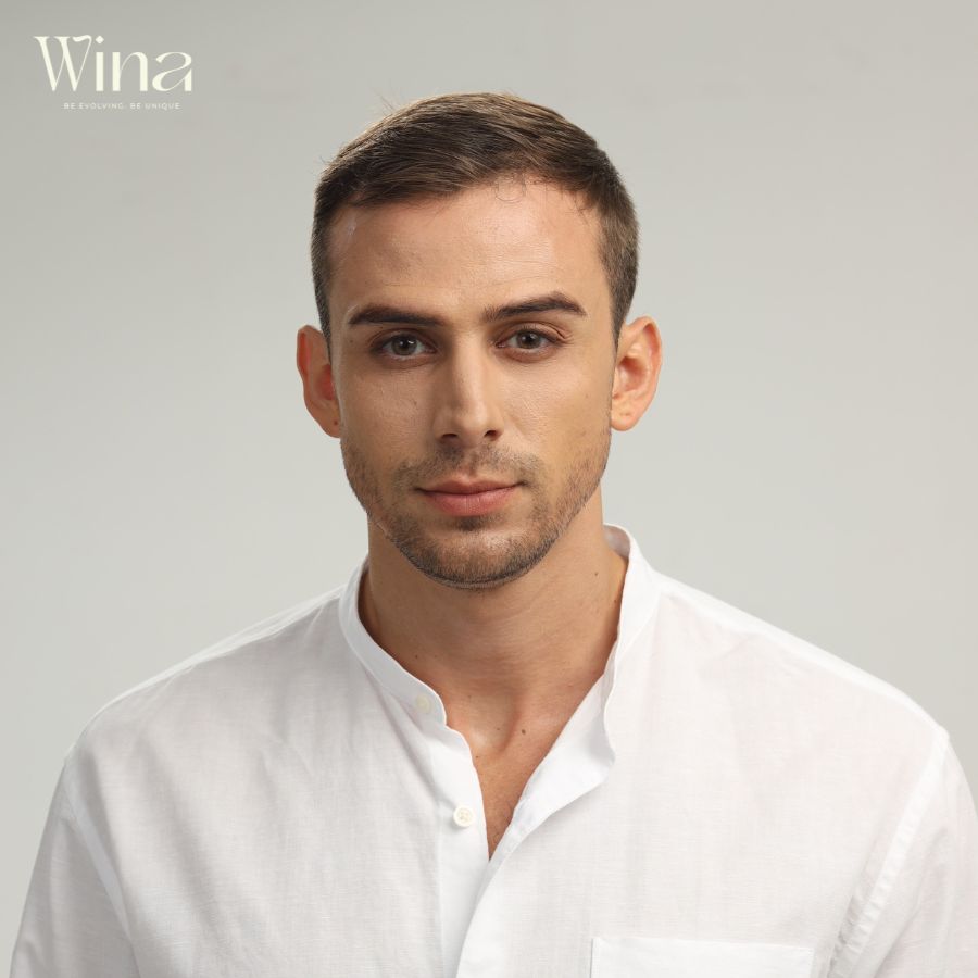 Tóc mái hói nam tự nhiên