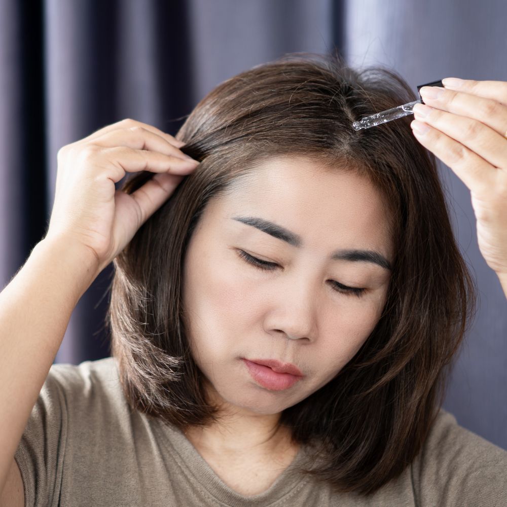 Nếu bạn chỉ thấy mới bắt đầu rụng tóc và mái tóc mảnh đi, các loại thuốc bôi (Minoxidil) hoặc thực phẩm chức năng có thể giúp làm chậm quá trình rụng