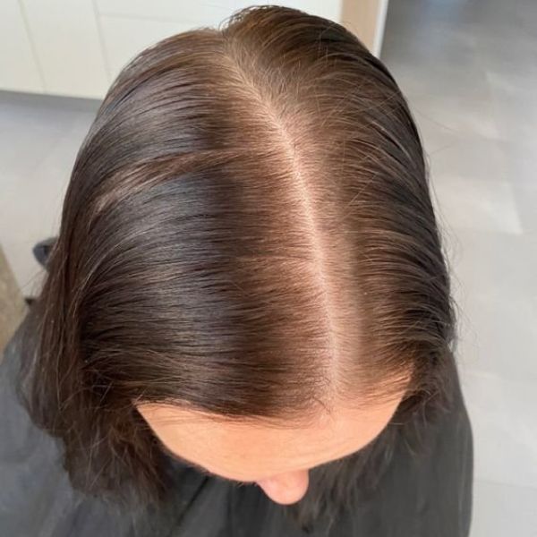 Rụng tóc, hói đầu hay mái tóc thưa mỏng theo thời gian không phải là điều gì đáng xấu hổ