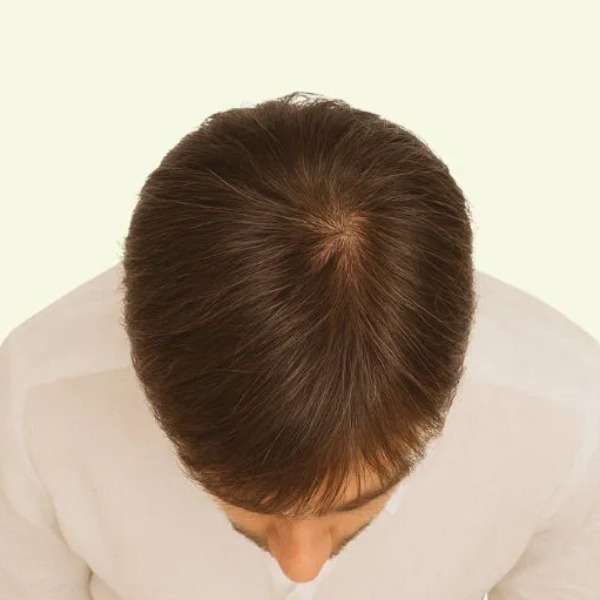 tóc giả nam nguyên đầu